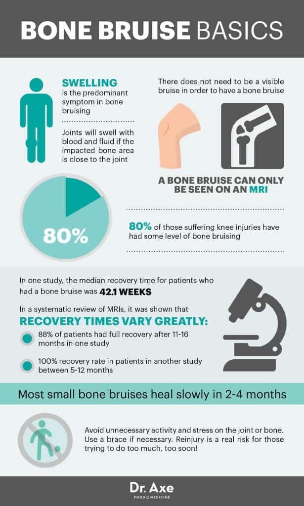 Bone Bruise Bedeutung Bone Bruise Der Schulter DDVLNE
