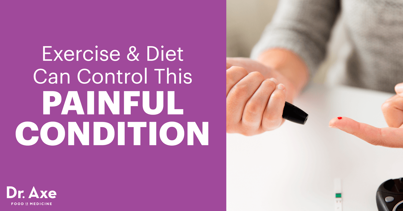 Exercise & Diet Can Control This Painful Condition