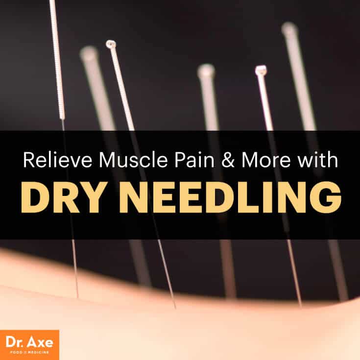 Relieve Muscle Pain & More with Dry Needling