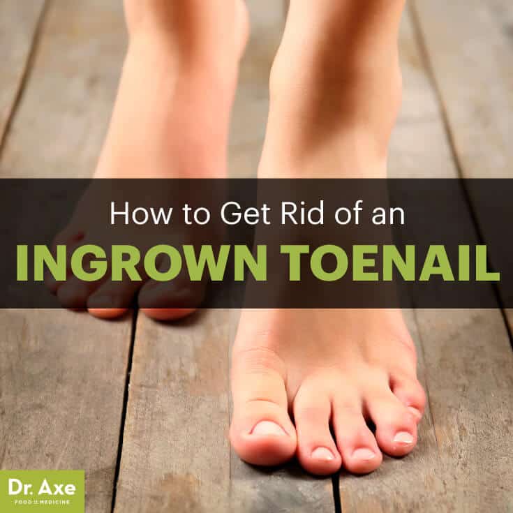 What ingrown toenail treatments have proven to be most effective?