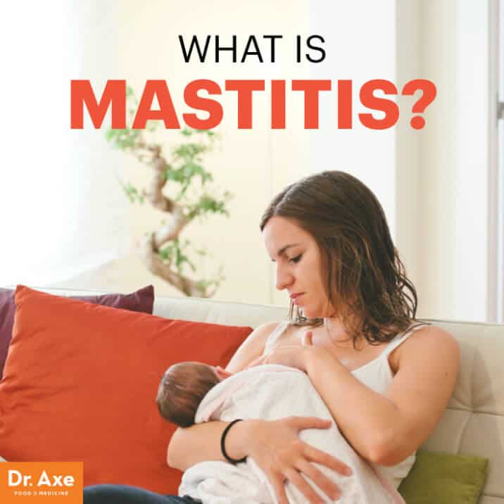 Treating Mastitis, the Most Common Breast-Feeding Infection