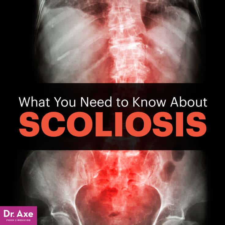 Scoliosis - Dr. Axe