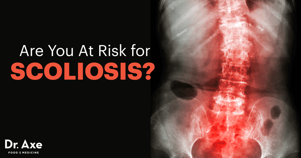 Scoliosis Symptoms, Risk Factors & Causes You Can Reverse