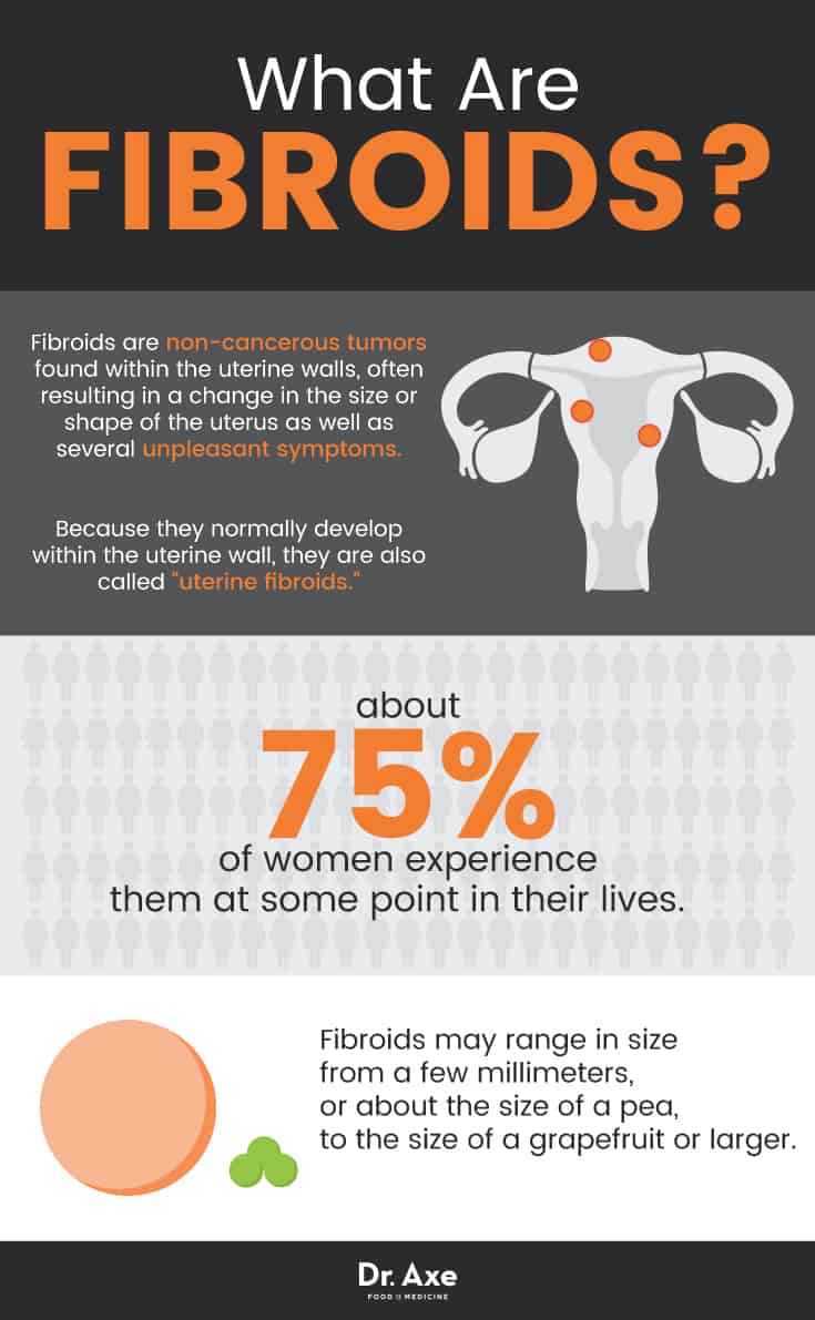 What are fibroids? - Dr. Axe