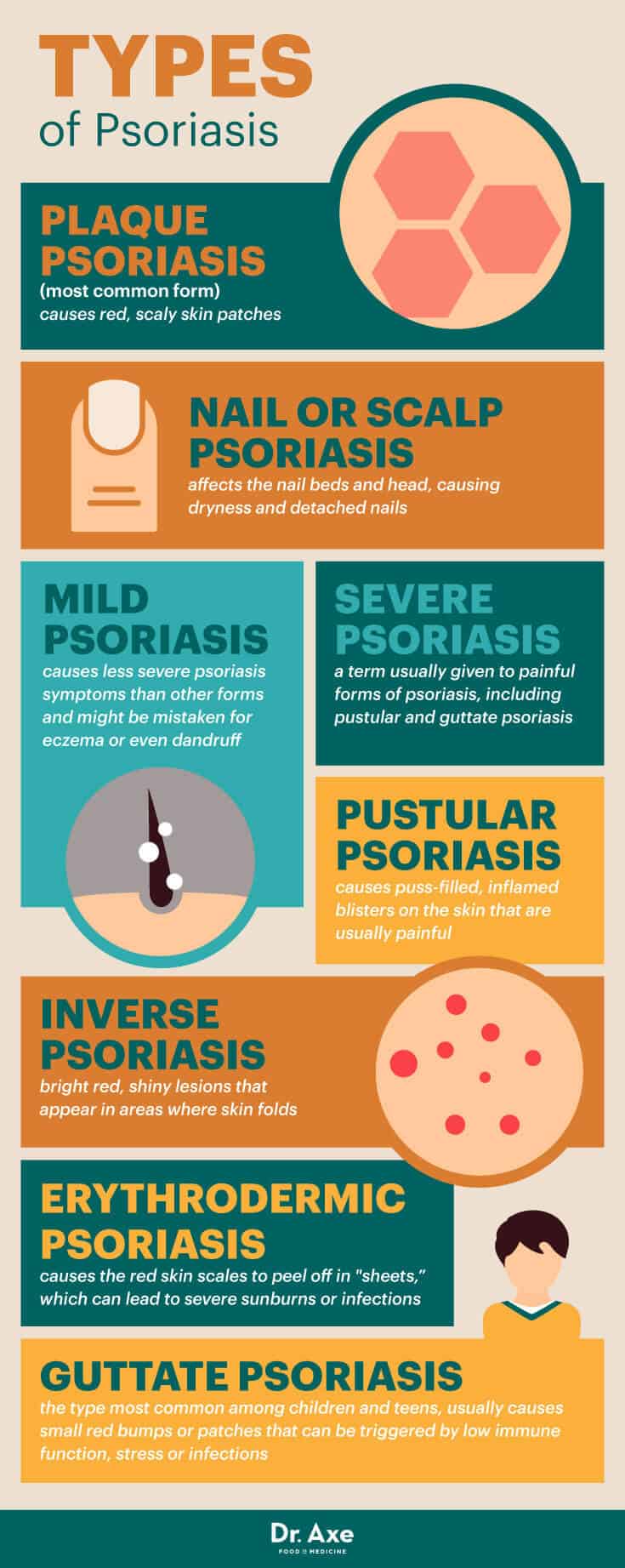 Types of psoriasis - Dr. Axe