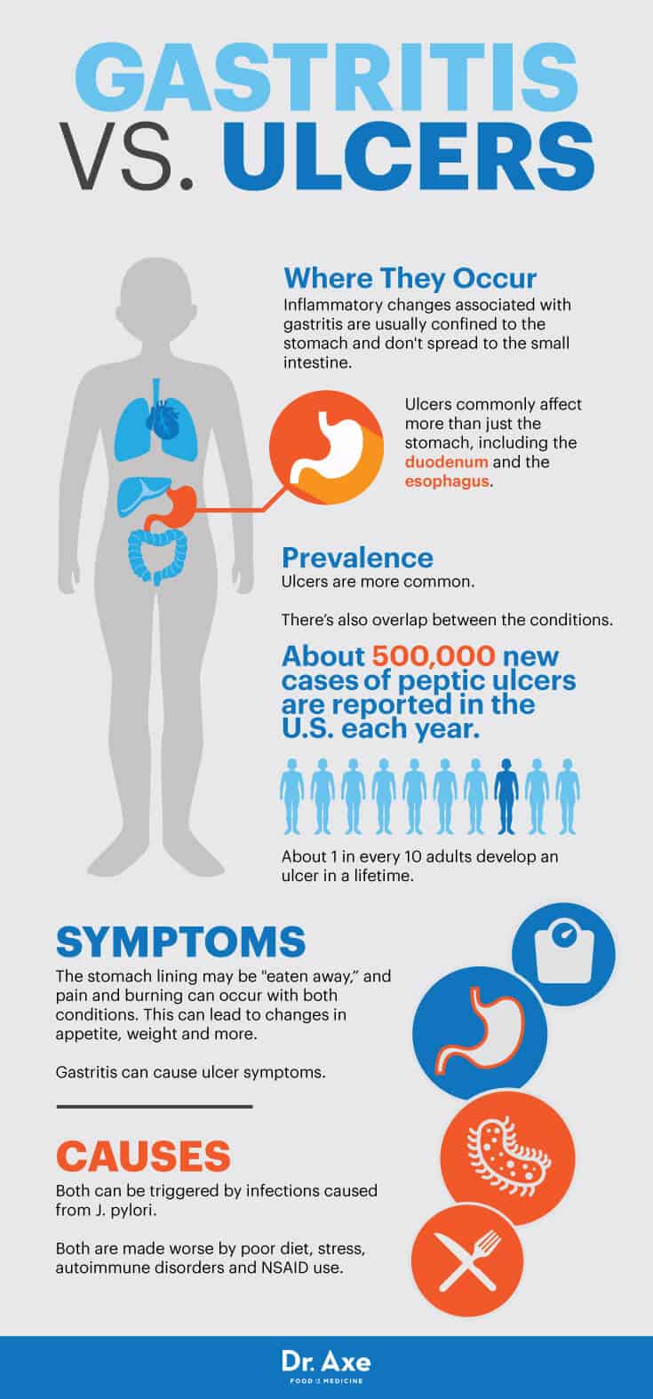Gastritis vs. ulcers - Dr. Axe