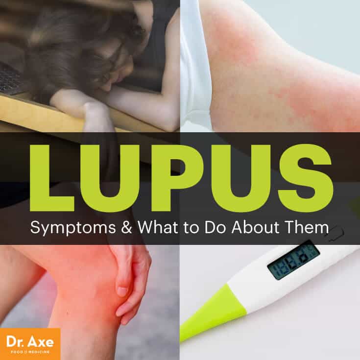 lupus-symptoms-6-natural-ways-to-manage-it-dr-axe