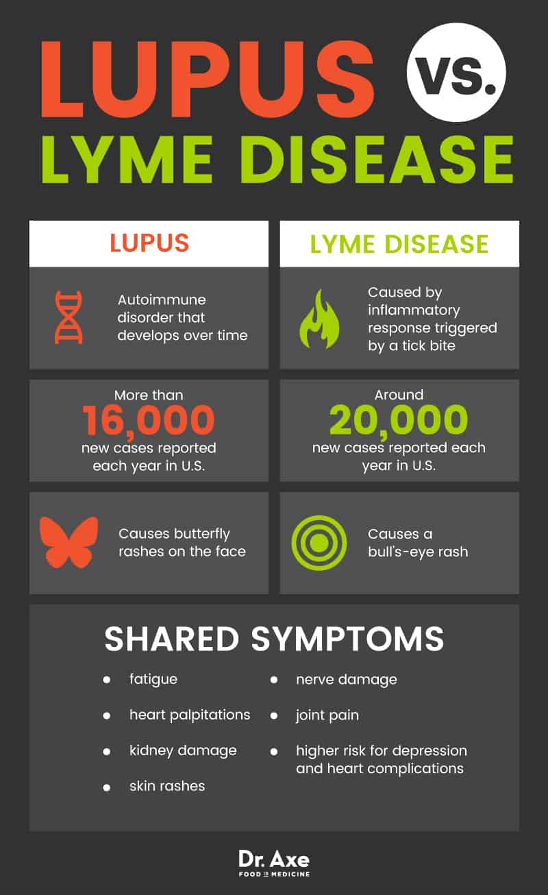Lupus symptoms: lupus vs. Lyme disease