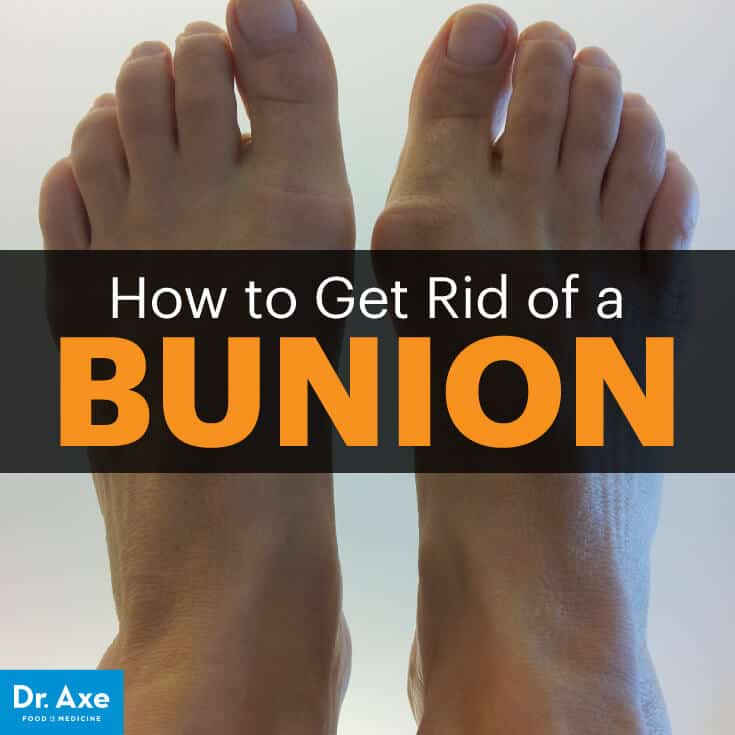 Bunion Symptoms, Causes & Natural Treatments Dr. Axe