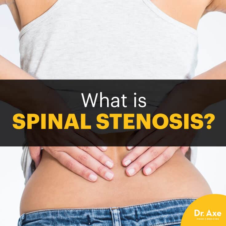 Spinal stenosis - Dr. Axe
