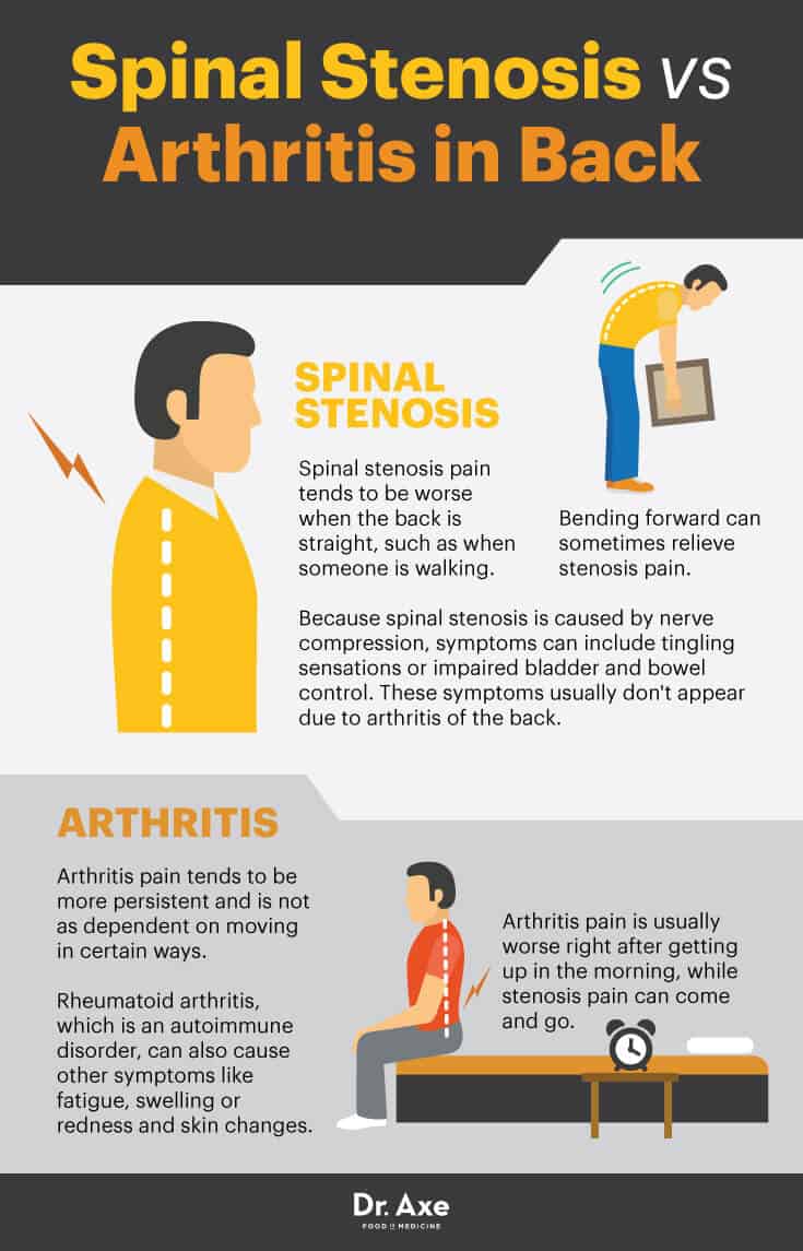 Spinal stenosis vs. arthritis in back - Dr. Axe