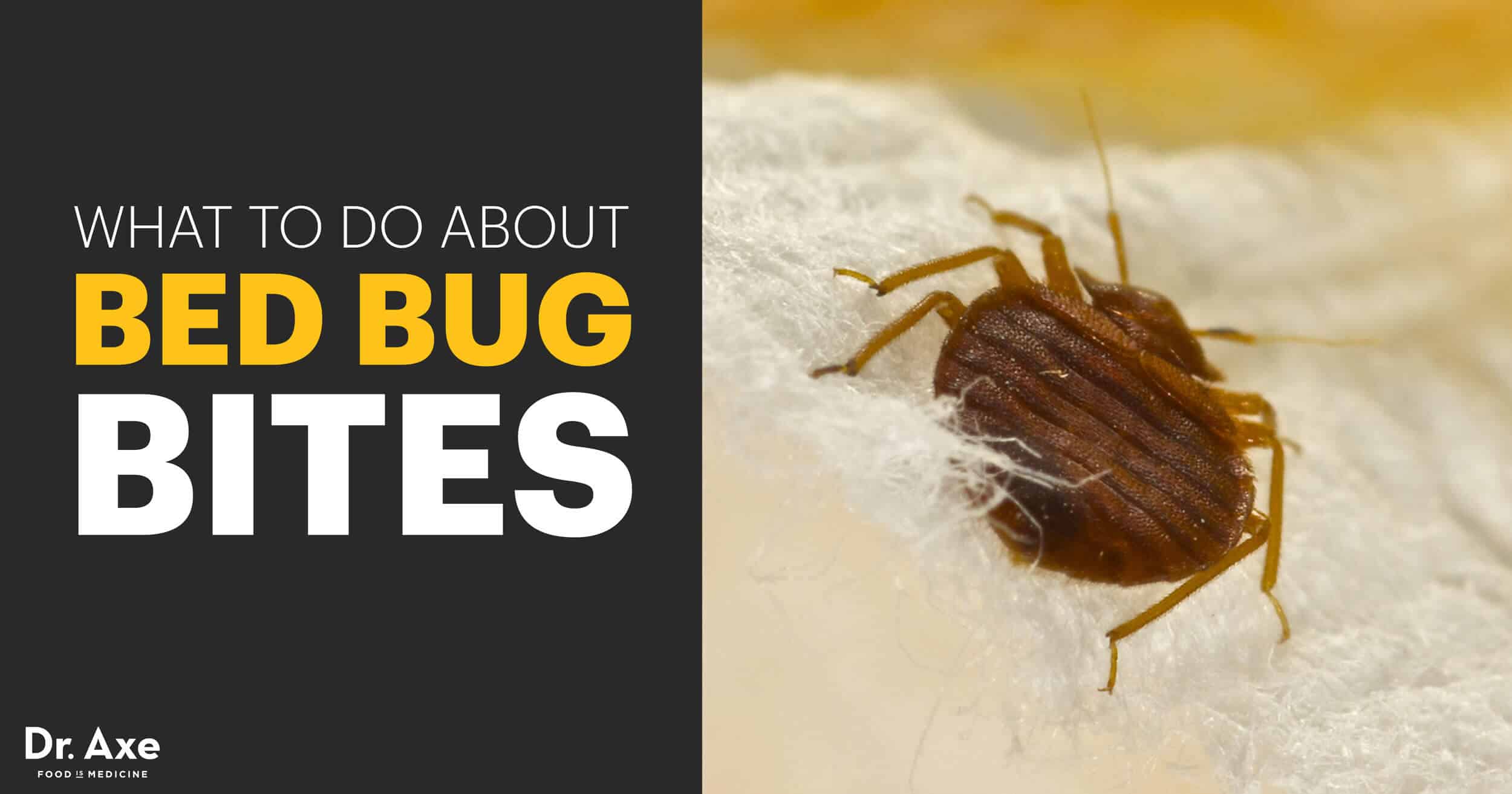 Bed Bug Bites: Symptoms, Facts & Natural Treatments - Dr. Axe