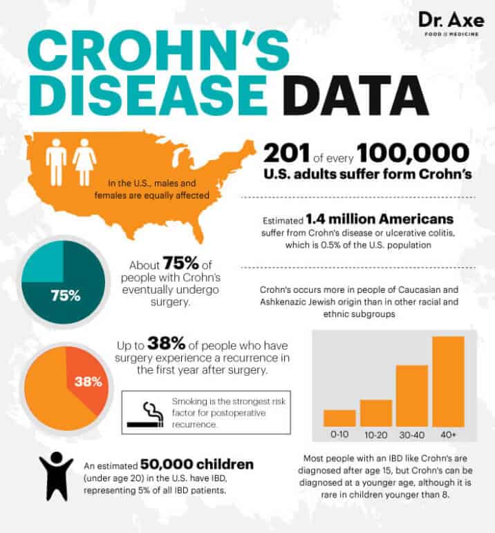 Crohn's Disease Symptoms, Facts and Risk Factors Dr. Axe