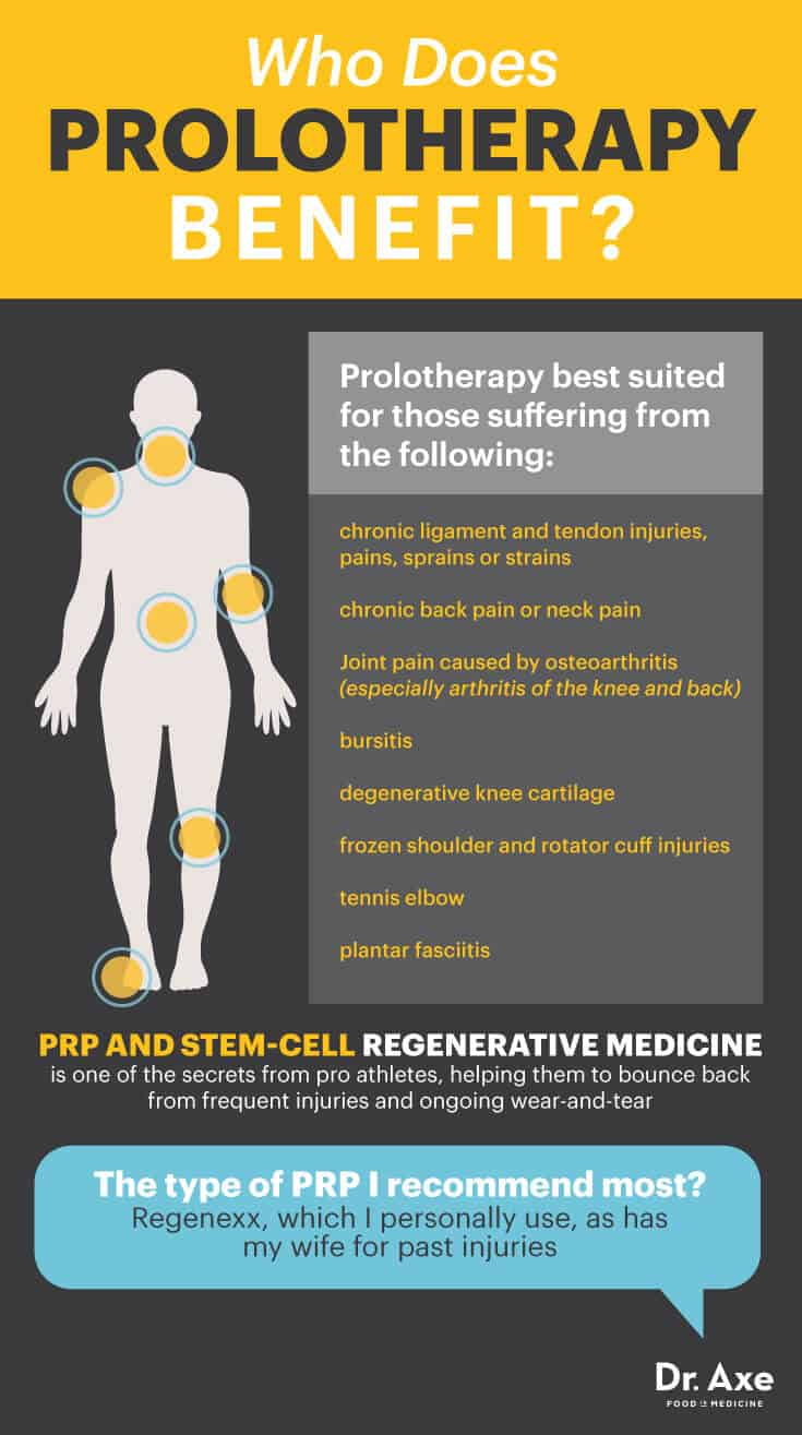 Prolotherapy benefits - Dr. axe