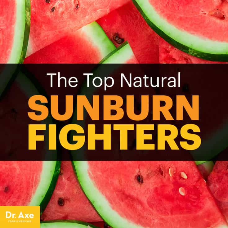 sunburn relief - dr. axe