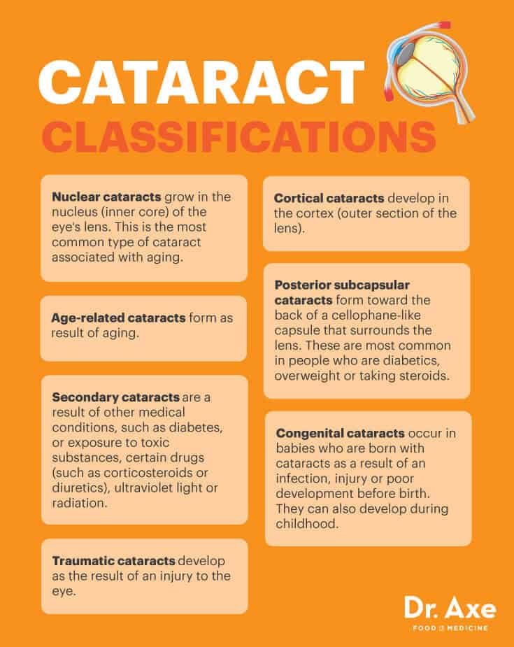 Cataract classifications - Dr. Axe