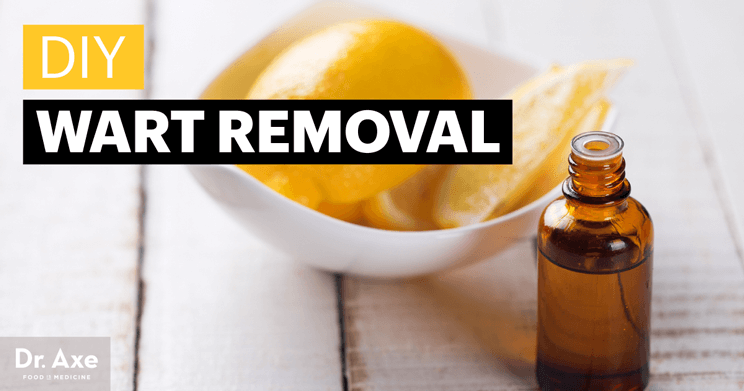 Diy Wart Remover Removal With Frankincense Lemon Essential Oils Dr Axe - Diy Wart Removal On Arm