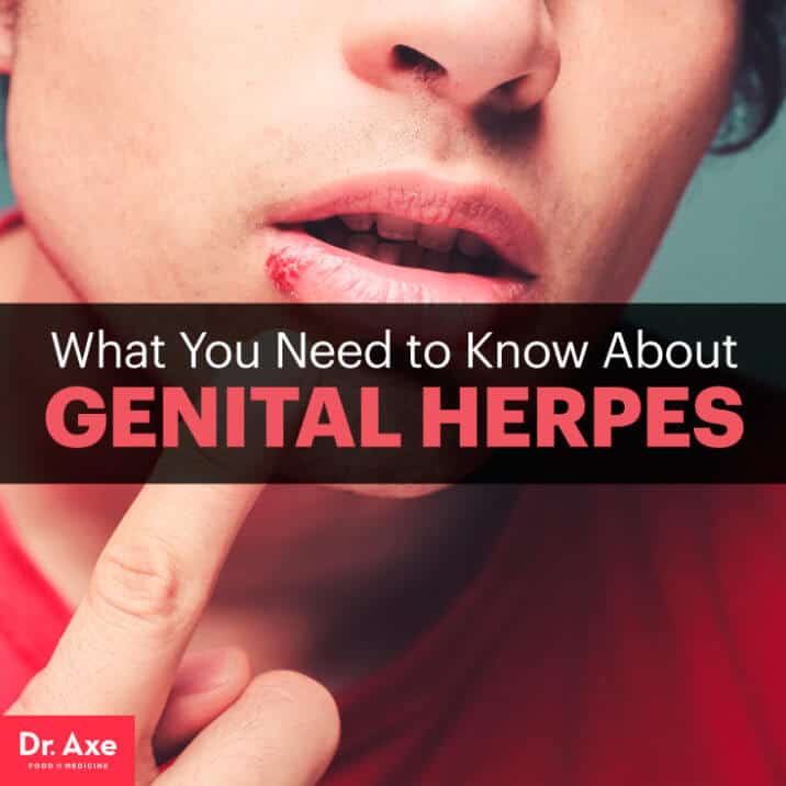 Genital Herpes Symptoms Risk Factors And Treatments Dr Axe