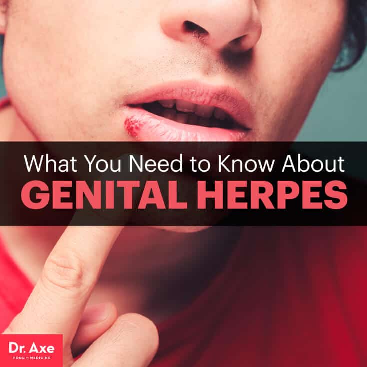 Genital herpes - Dr. Axe