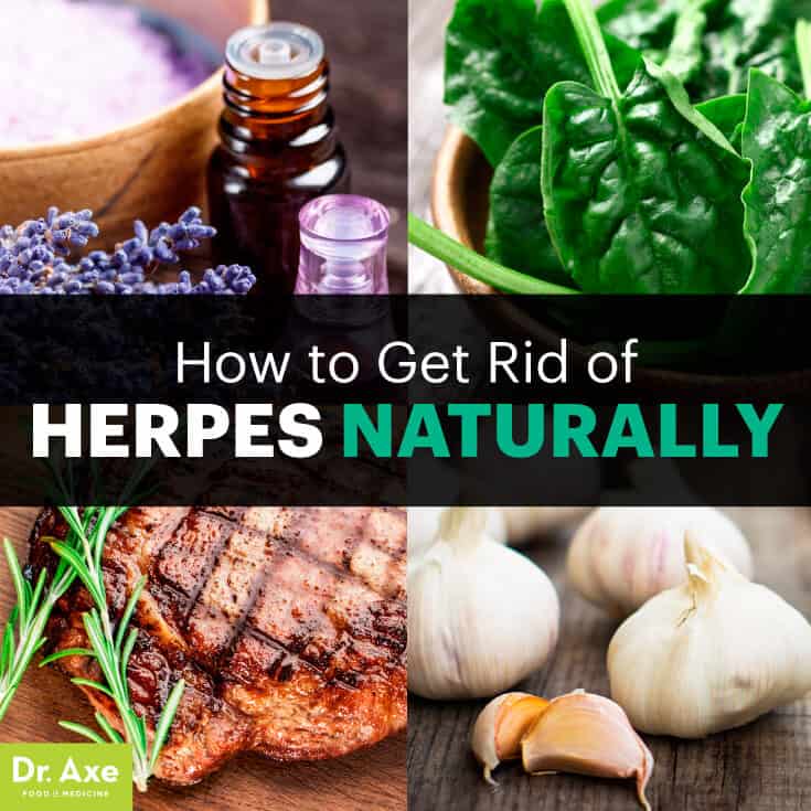 How To Get Rid Of Herpes Symptoms Naturally 5 Ways Dr Axe