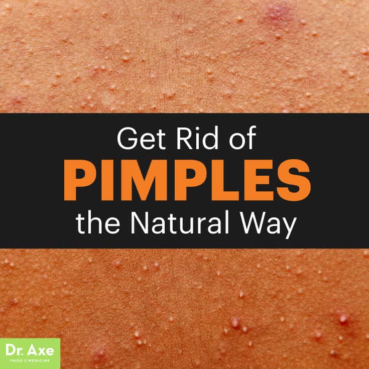How to get rid of pimples - Dr. Axe