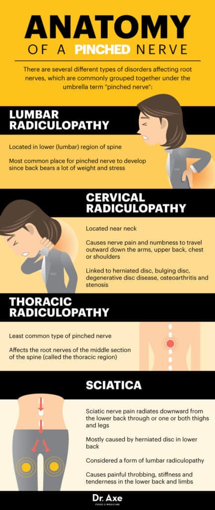 pinched-nerve-symptoms-locations-treatments-dr-axe