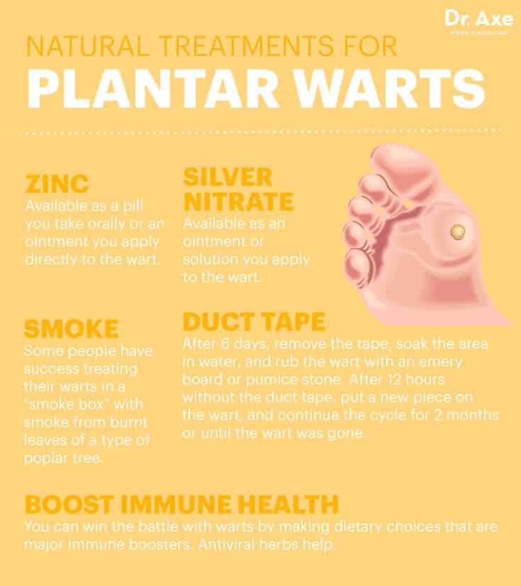 Plantar warts natural treatments - Dr. Axe