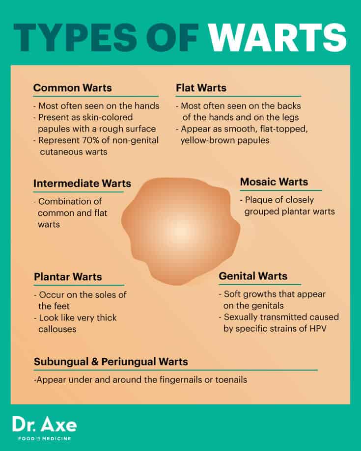Types of warts - Dr. Axe