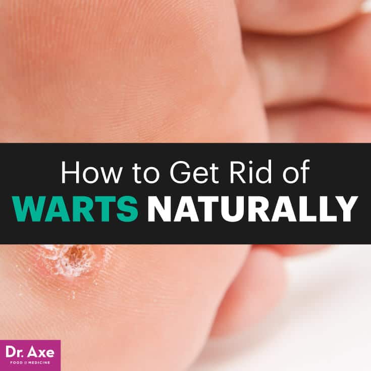 How To Get Rid Of Warts Naturally Wart Symptoms Causes Dr Axe