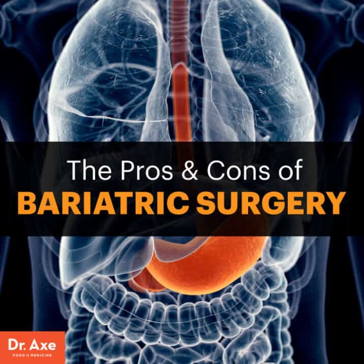 The Pros & Cons Of Bariatric Surgery + Healthier Alternatives - Dr. Axe