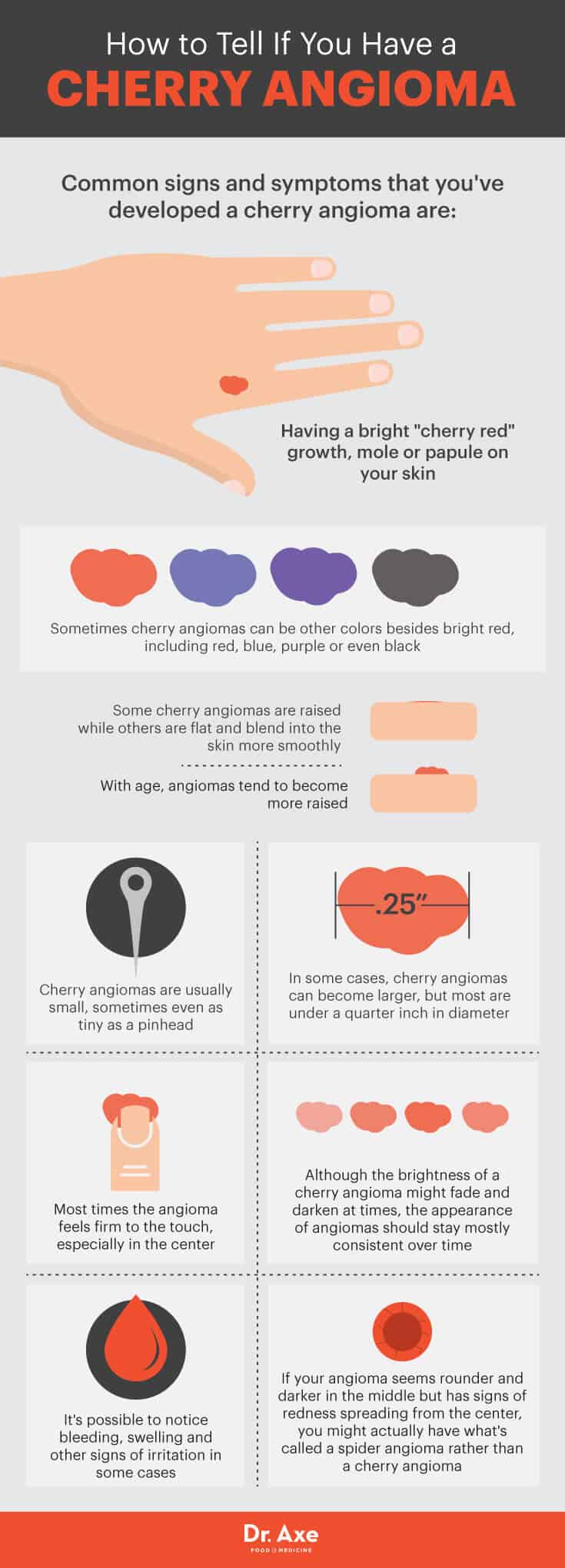 How to tell you have a cherry angioma - Dr. Axe