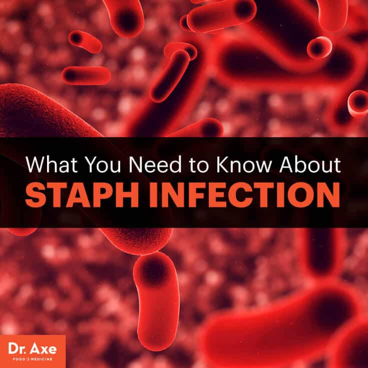 Staph infection - Dr. Axe
