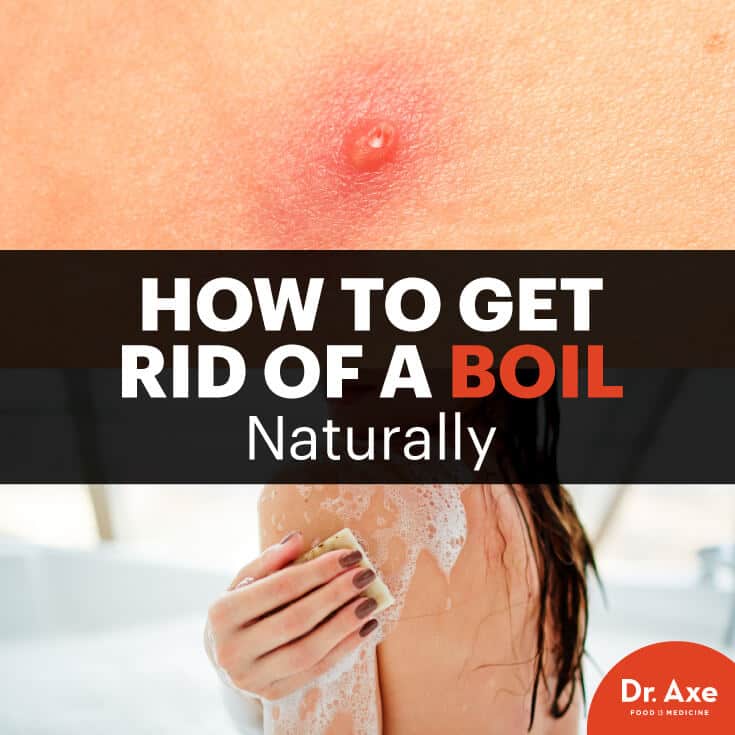 How to get rid of a boil - Dr. Axe
