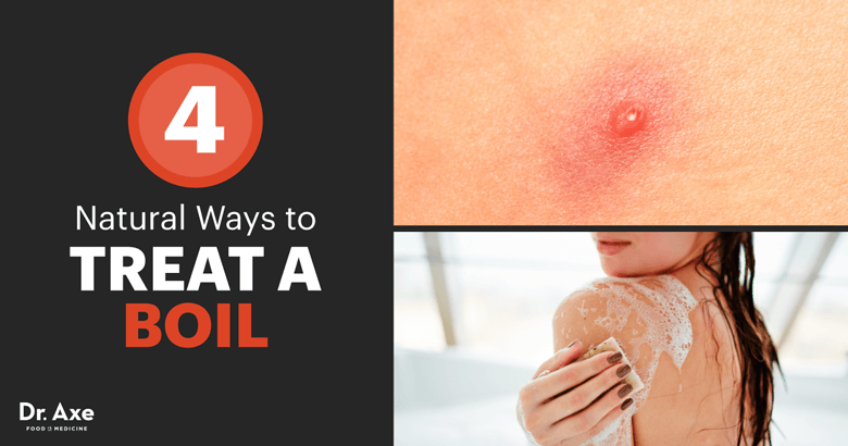 Hot to Get Rid of a Boil & How to Prevent Boils - Dr. Axe