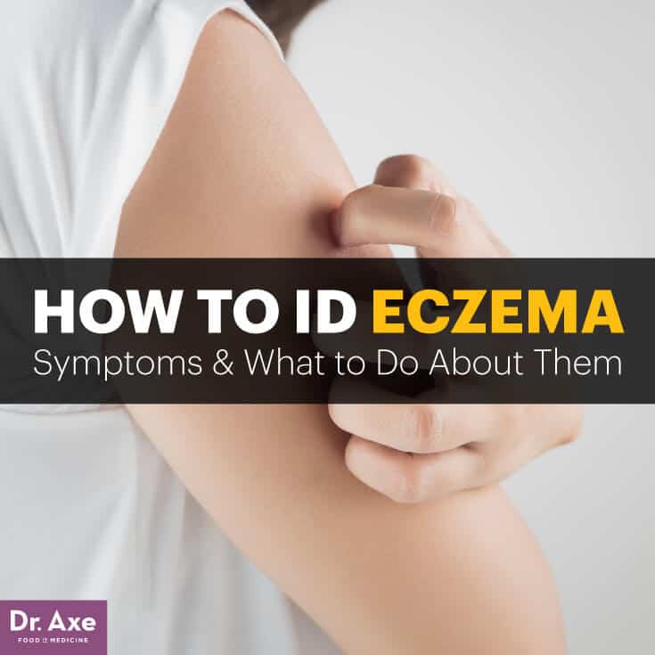 What Are Eczema Symptoms? Plus 5 Natural Treatments - Dr. Axe