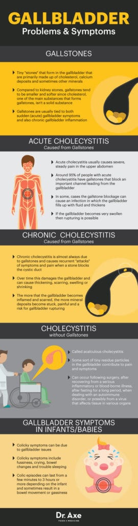 Gallbladder Inflammation Symptoms Signs Complications - vrogue.co