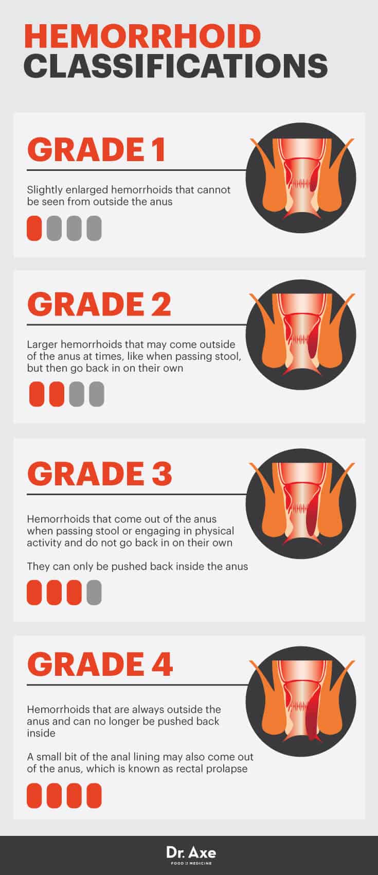 Hemorrhoid classifications - Dr. Axe