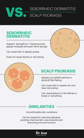 Seborrheic Dermatitis Causes + 7 Natural Treatments - Dr. Axe