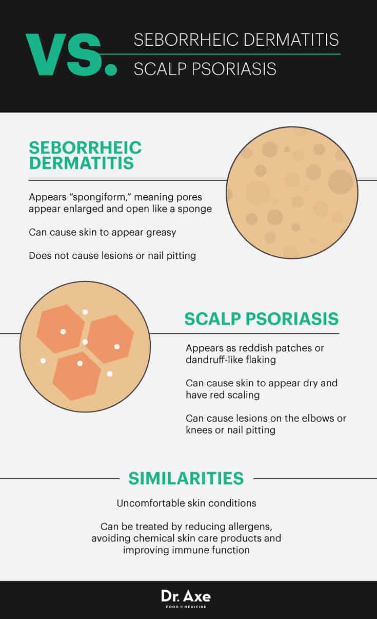 Seborrheic dermatitis vs. scalp psoriasis - Dr. Axe