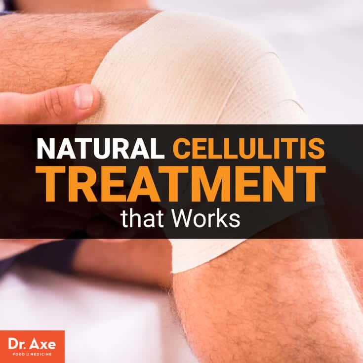 Cellulitis treatment - Dr. Axe