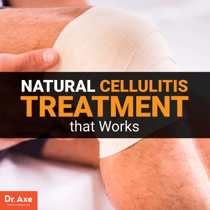 Cellulitis behandeling - Dr. Axe