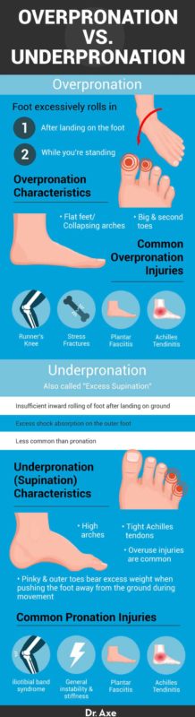 Pronation Problems: Signs, Causes and Ways to Correct - Dr. Axe