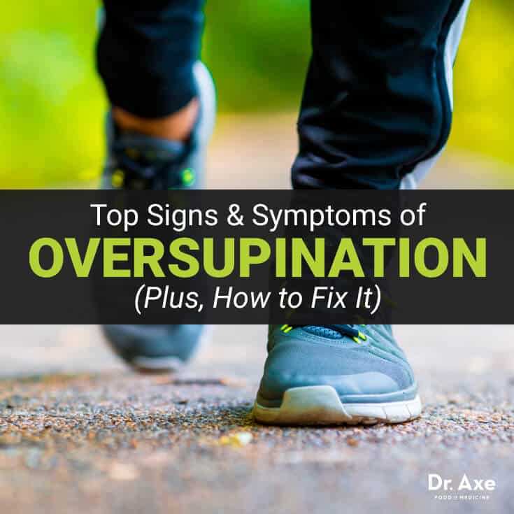 Do you Suffer from Excess Supination 