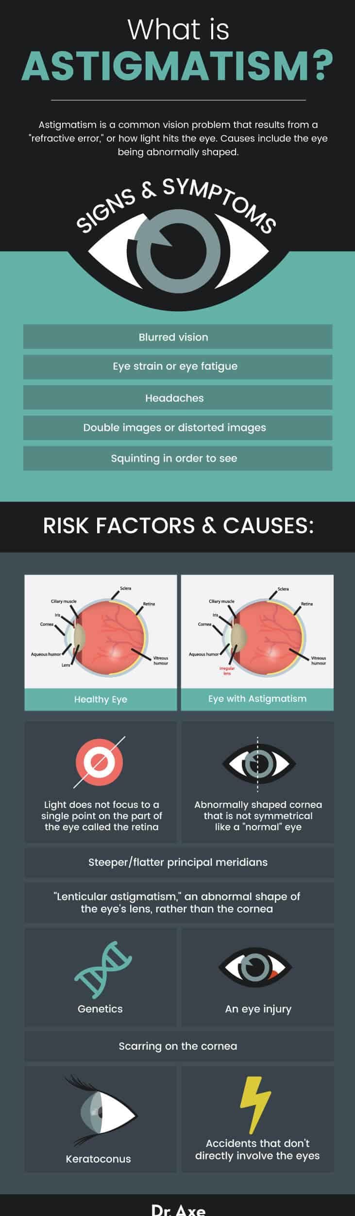 astigmatism symptoms, risk factors & causes