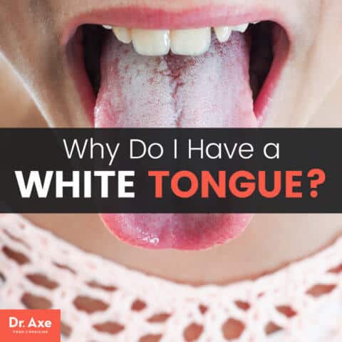 White Tongue Causes & 10 Natural Treatments for White Tongue - Dr. Axe