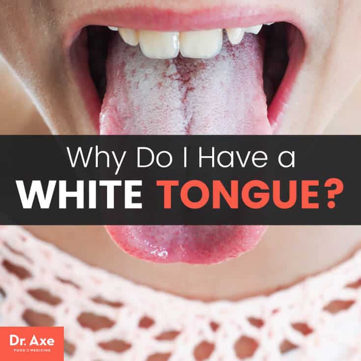 White tongue - Dr. Axe
