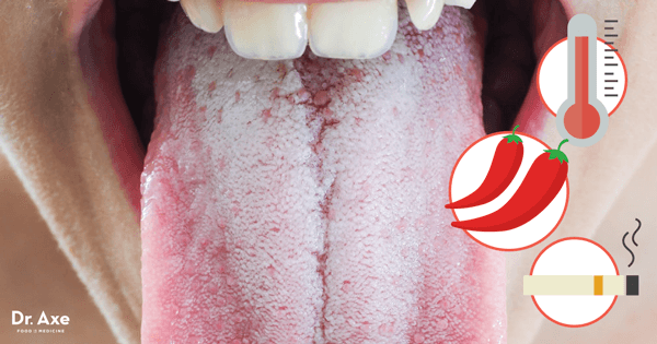 Produktion pouch Angreb White Tongue Causes & 10 Natural Treatments for White Tongue - Dr. Axe