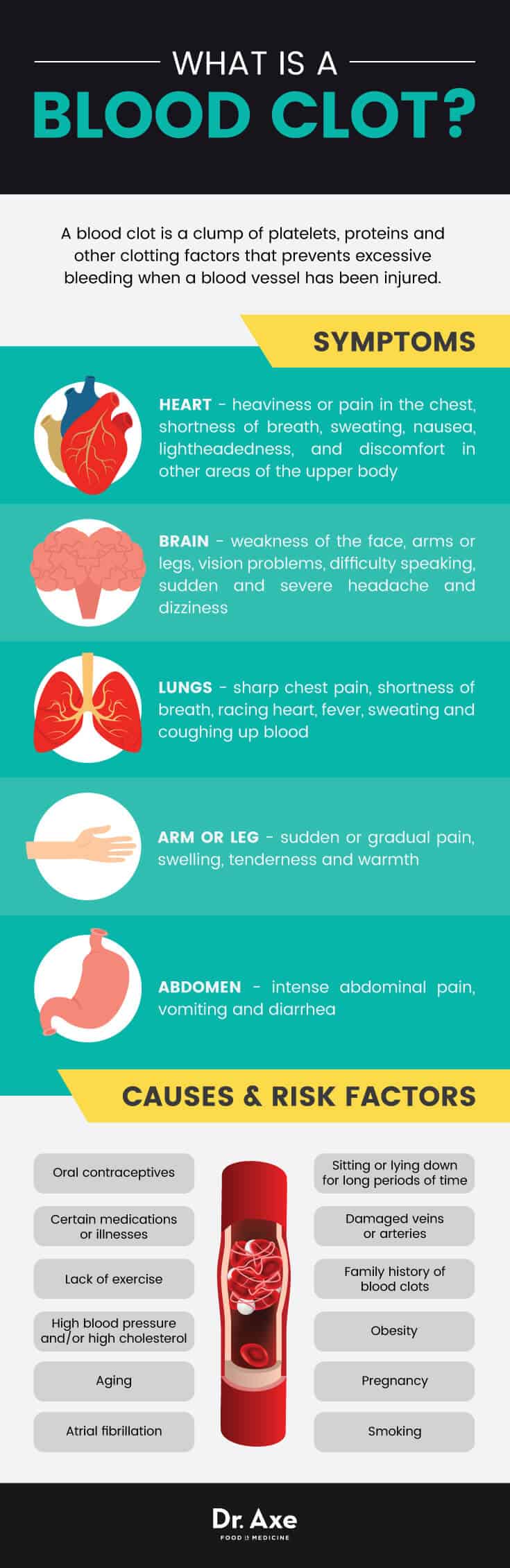 Period Blood Clots: Causes & How To Manage Them