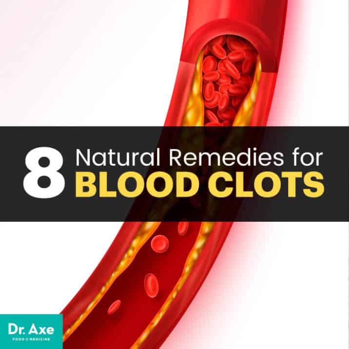 Blood Clots Causes And Symptoms 8 Natural Remedies Dr Axe