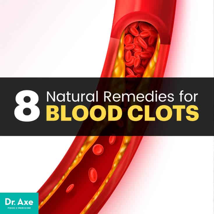 Blood Clots Causes & Symptoms + 8 Natural Remedies + Dr. Axe